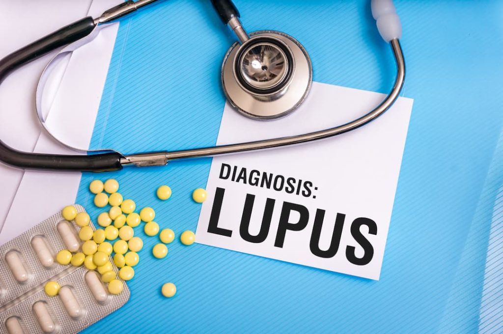 7-steps-to-win-or-increase-your-lupus-va-rating